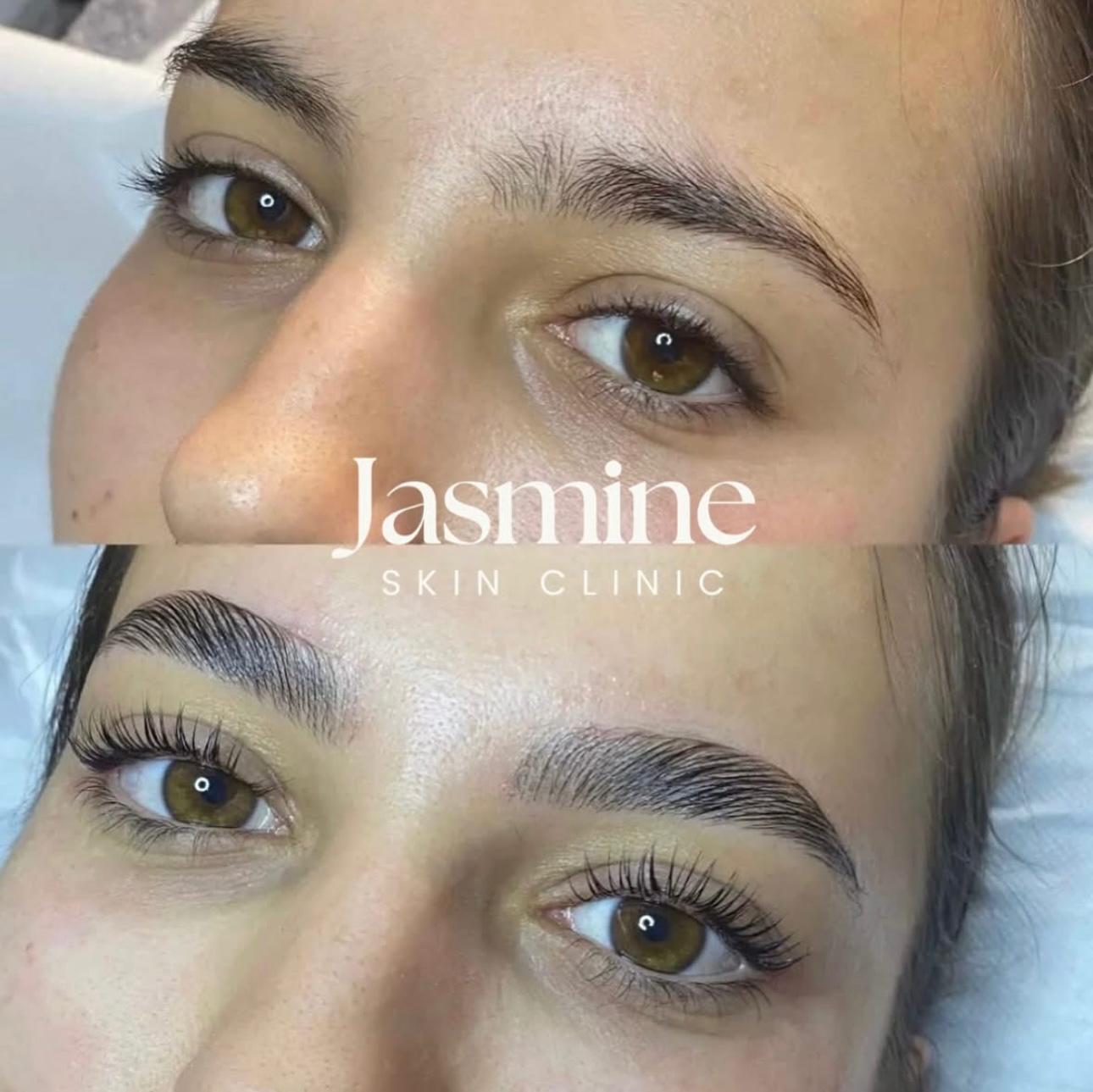 Résultat Brow Lift publié par Jasmine Skin à El Jadida